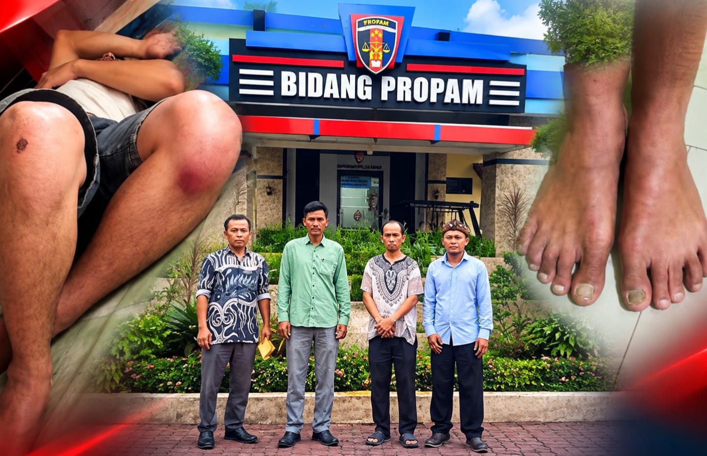 Seorang Pria Warga Kabupaten Dairi Mengaku Disiksa Oleh 7 Personil Polres Samosir, Kini Melapor Ke Propam Polda Sumut